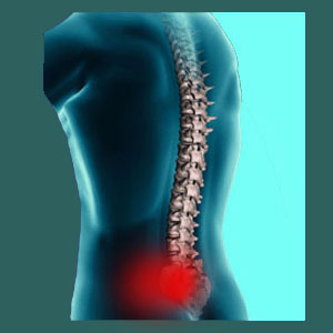 Acute sacroiliac pain