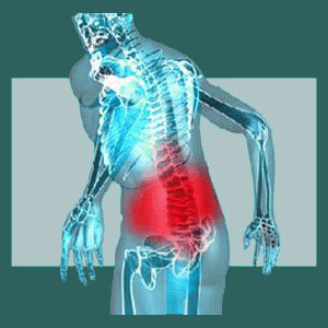 Elderly Sacroiliac Pain