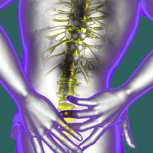 Hypermobile Sacroiliac Joint