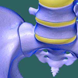 Hypomobile Sacroiliac Joint