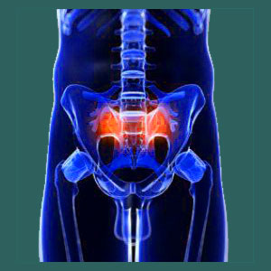 Knowledge therapy for sacroiliac