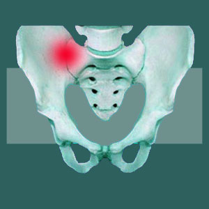 Obesity Sacroiliac Pain