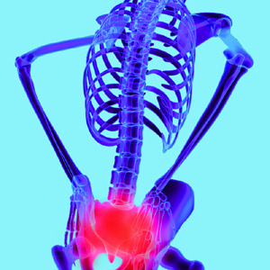 Prolotherapy Injections for Sacroiliac