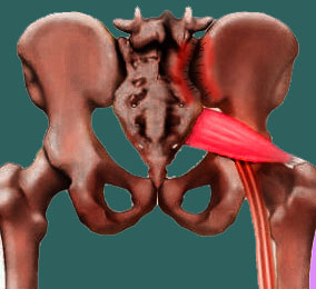 Rheumatoid Arthritis Sacroiliac