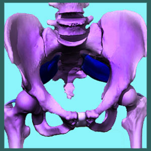 Sacroiliac Degeneration