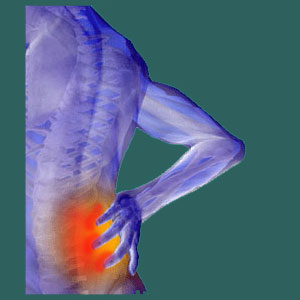 Douleur de la hanche sacro-iliaque