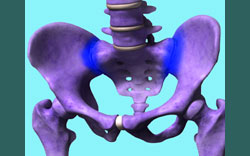 sacroiliac joint dysfunction