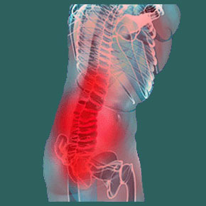 Sacroiliac joint ischemia