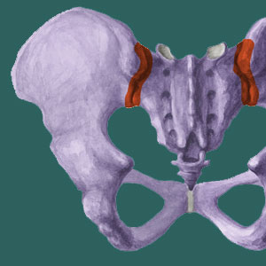 Sacroiliac Pain