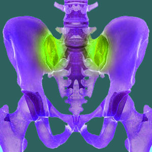 sacroiliac pain after spinal fusion