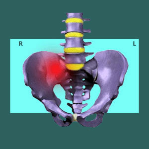 Right Side Sacroiliac Pain 