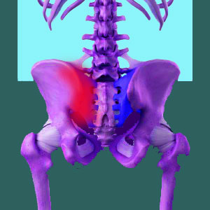 Sacroiliac pain standing