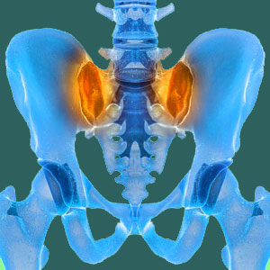 Sacroiliac scapegoat