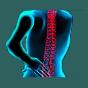 Tension myositis syndrome sacroiliac